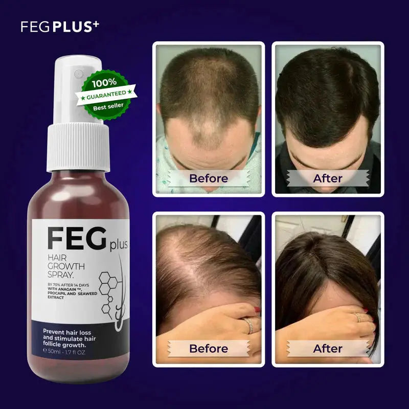 FEG PLUS Hair & Beard Growth Serum Spray 50ml
